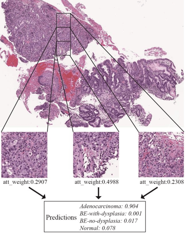 Figure 1 for Finding a Needle in the Haystack: Attention-Based Classification of High Resolution Microscopy Images