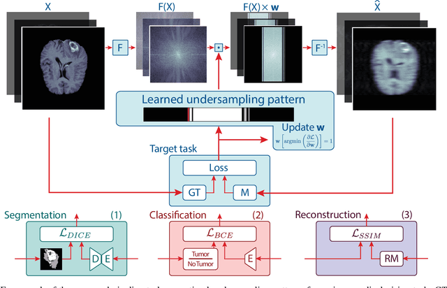 Figure 1 for Optimal MRI Undersampling Patterns for Ultimate Benefit of Medical Vision Tasks