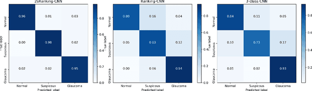 Figure 4 for 2sRanking-CNN: A 2-stage ranking-CNN for diagnosis of glaucoma from fundus images using CAM-extracted ROI as an intermediate input