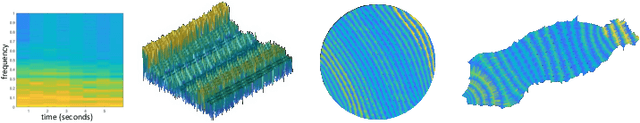 Figure 4 for Distortion measure of spectrograms for classification of respiratory diseases