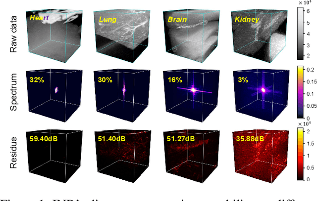 Figure 1 for SCI: A spectrum concentrated implicit neural compression for biomedical data