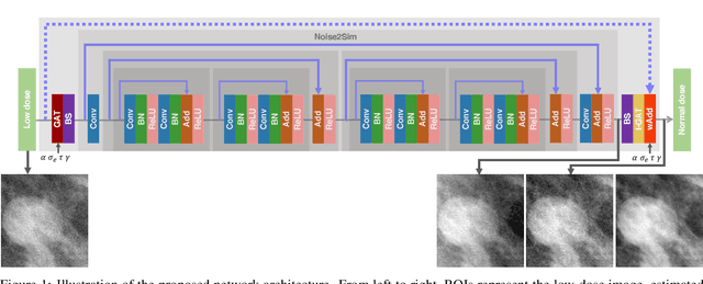 Figure 1 for Convolutional Neural Network to Restore Low-Dose Digital Breast Tomosynthesis Projections in a Variance Stabilization Domain