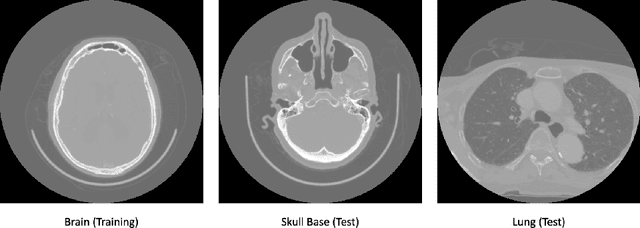 Figure 1 for Does Proprietary Software Still Offer Protection of Intellectual Property in the Age of Machine Learning? -- A Case Study using Dual Energy CT Data