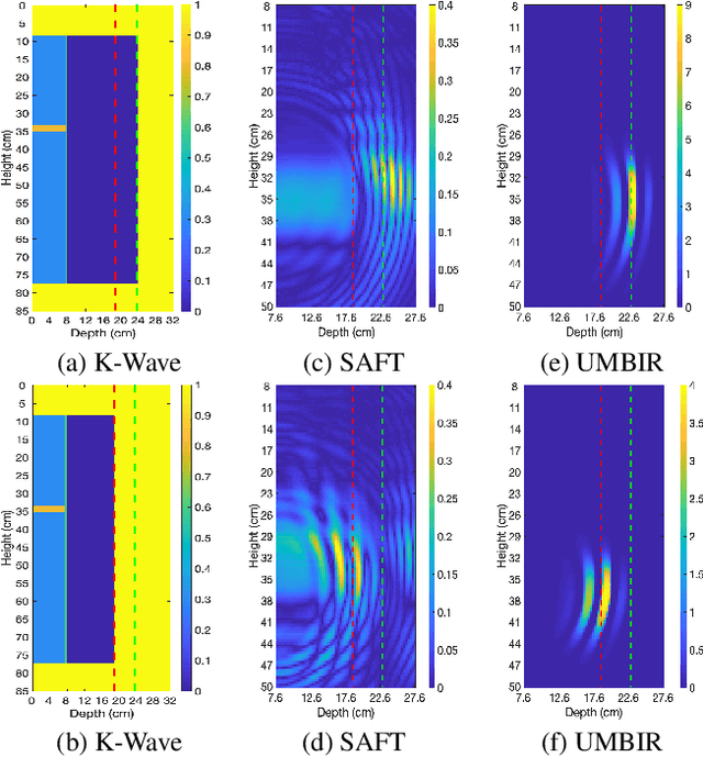 Figure 4 for Model-Based Reconstruction for Collimated Beam Ultrasound Systems