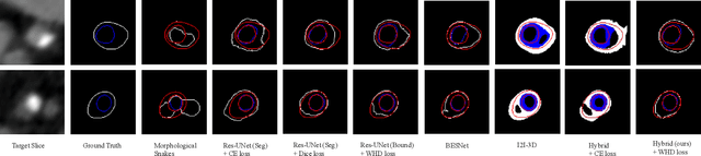 Figure 3 for Coronary Wall Segmentation in CCTA Scans via a Hybrid Net with Contours Regularization