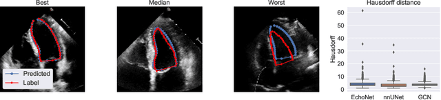 Figure 3 for Light-weight spatio-temporal graphs for segmentation and ejection fraction prediction in cardiac ultrasound