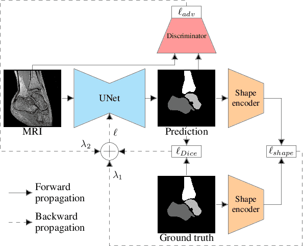 Figure 3 for Multi-structure bone segmentation in pediatric MR images with combined regularization from shape priors and adversarial network