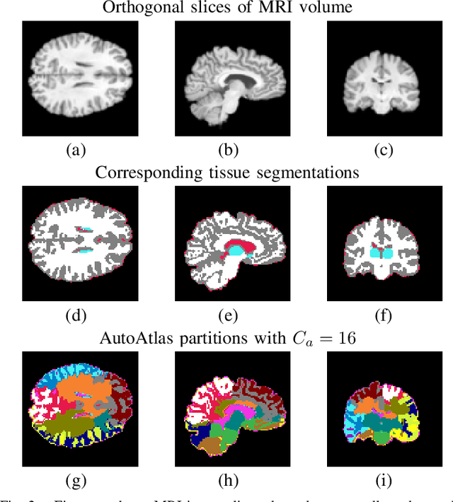 Figure 2 for AutoAtlas: Neural Network for 3D Unsupervised Partitioning and Representation Learning