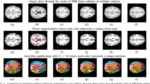 Figure 4 for AutoAtlas: Neural Network for 3D Unsupervised Partitioning and Representation Learning