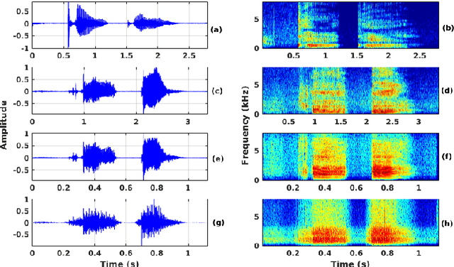 Figure 2 for Processing Phoneme Specific Segments for Cleft Lip and Palate Speech Enhancement