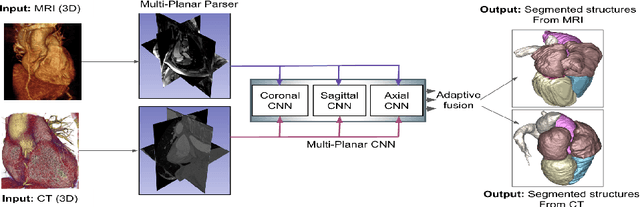 Figure 1 for Multi-Planar Deep Segmentation Networks for Cardiac Substructures from MRI and CT