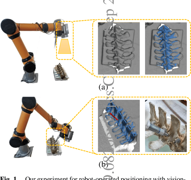 Figure 1 for 6DOF Pose Estimation of a 3D Rigid Object based on Edge-enhanced Point Pair Features