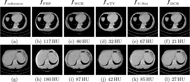 Figure 3 for Field of View Extension in Computed Tomography Using Deep Learning Prior