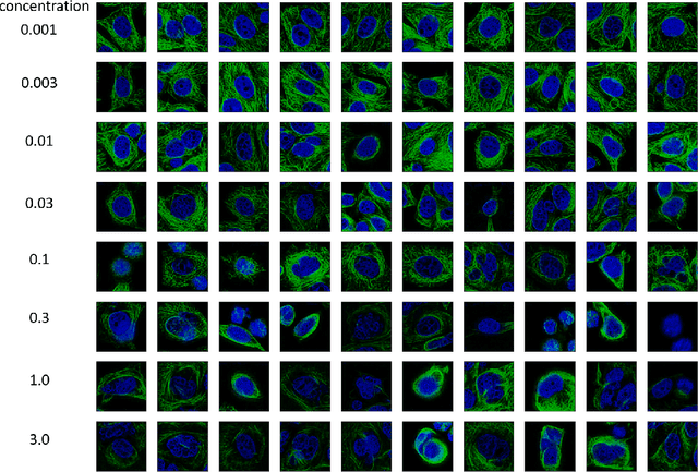 Figure 3 for Enhancing high-content imaging for studying microtubule networks at large-scale