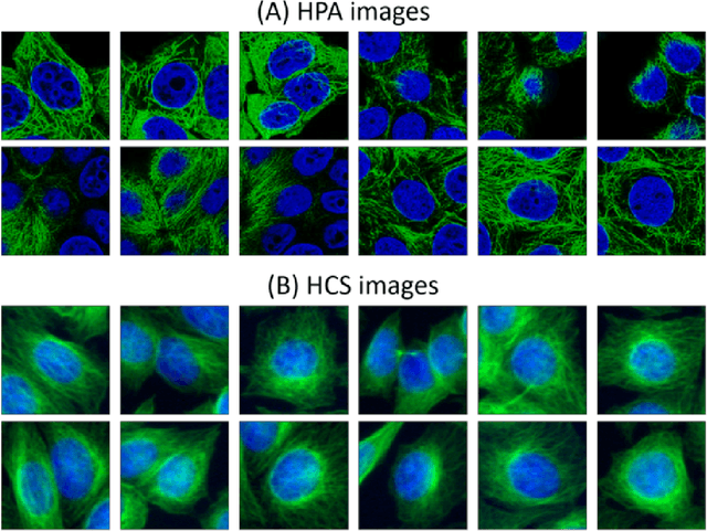 Figure 4 for Enhancing high-content imaging for studying microtubule networks at large-scale