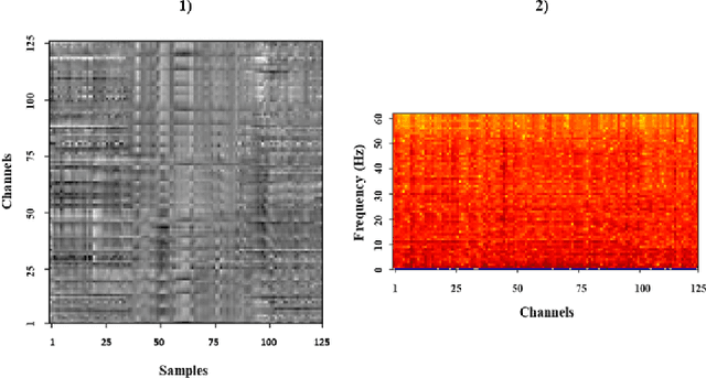Figure 1 for Image-based eeg classification of brain responses to song recordings
