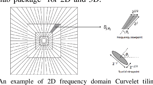 Figure 4 for Photoacoustic Reconstruction Using Sparsity in Curvelet Frame