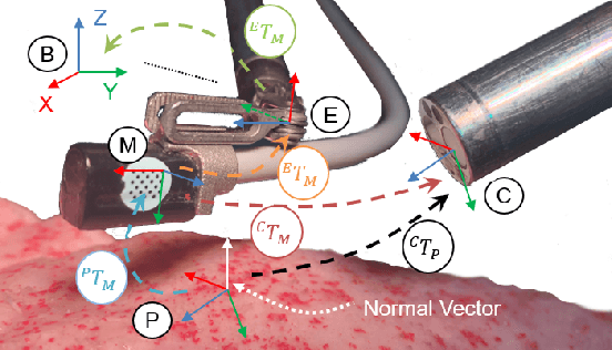 Figure 1 for Autonomous Tissue Scanning under Free-Form Motion for Intraoperative Tissue Characterisation