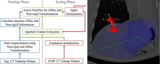 Figure 1 for Action Learning for 3D Point Cloud Based Organ Segmentation
