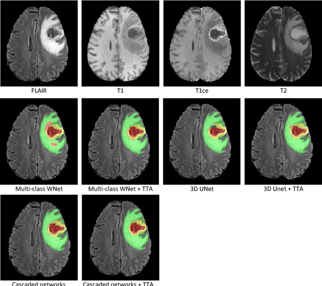 Figure 3 for Automatic Brain Tumor Segmentation using Convolutional Neural Networks with Test-Time Augmentation