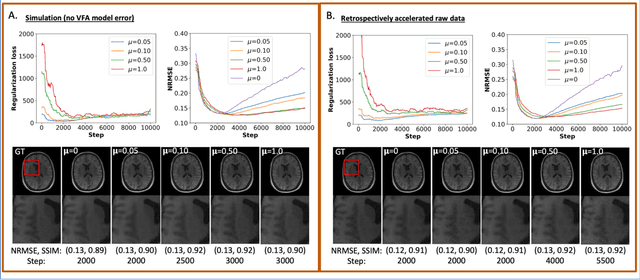Figure 3 for An untrained deep learning method for reconstructing dynamic magnetic resonance images from accelerated model-based data