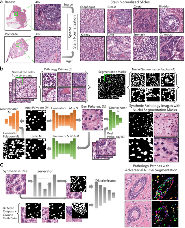 Figure 1 for Deep Adversarial Training for Multi-Organ Nuclei Segmentation in Histopathology Images