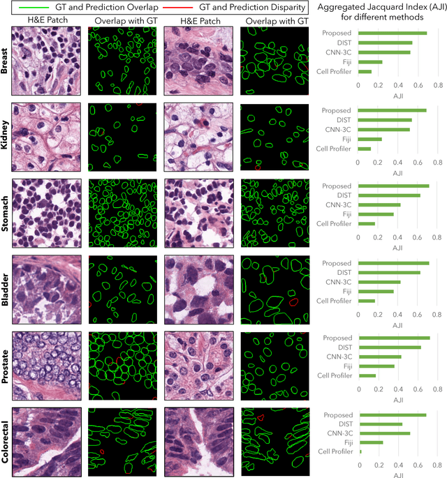 Figure 2 for Deep Adversarial Training for Multi-Organ Nuclei Segmentation in Histopathology Images
