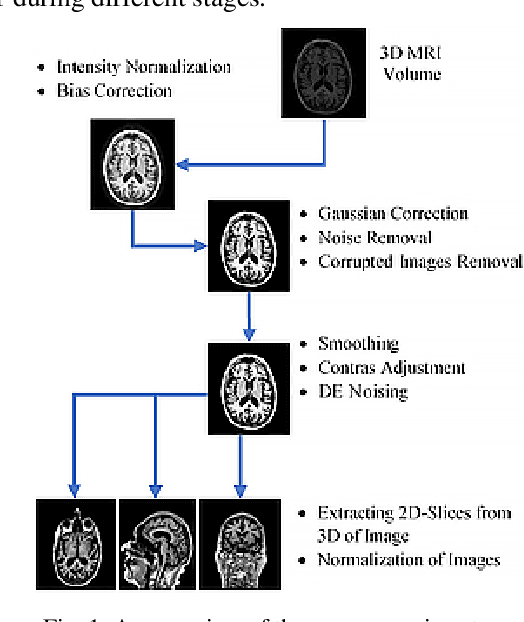 Figure 1 for Deep Convolutional Neural Network based Classification of Alzheimer's Disease using MRI data