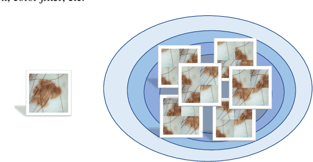 Figure 4 for MIPR:Automatic Annotation of Medical Images with Pixel Rearrangement