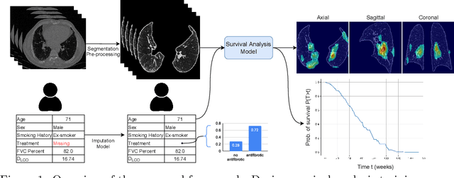 Figure 1 for Survival Analysis for Idiopathic Pulmonary Fibrosis using CT Images and Incomplete Clinical Data