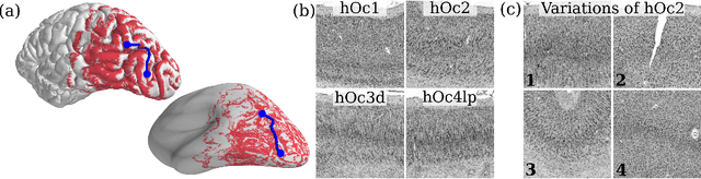 Figure 1 for Improving Cytoarchitectonic Segmentation of Human Brain Areas with Self-supervised Siamese Networks