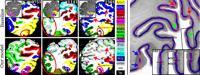 Figure 4 for Improving Cytoarchitectonic Segmentation of Human Brain Areas with Self-supervised Siamese Networks
