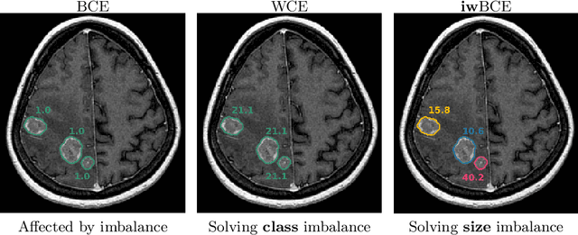 Figure 1 for Universal Loss Reweighting to Balance Lesion Size Inequality in 3D Medical Image Segmentation