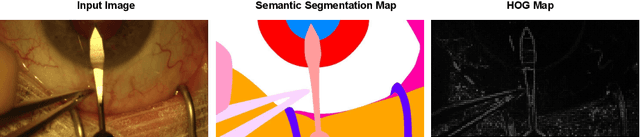 Figure 1 for Histogram of Oriented Gradients Meet Deep Learning: A Novel Multi-task Deep Network for Medical Image Semantic Segmentation