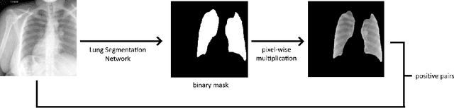 Figure 3 for Representative Image Feature Extraction via Contrastive Learning Pretraining for Chest X-ray Report Generation