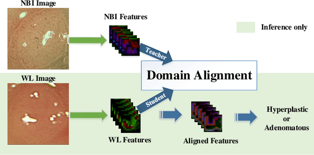 Figure 1 for Colorectal Polyp Classification from White-light Colonoscopy Images via Domain Alignment