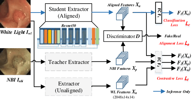 Figure 3 for Colorectal Polyp Classification from White-light Colonoscopy Images via Domain Alignment