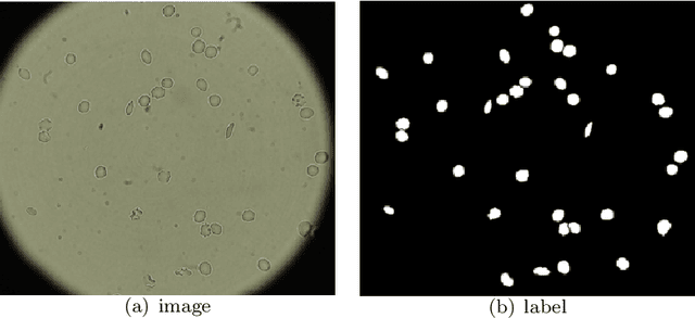 Figure 4 for Multi-label Detection and Classification of Red Blood Cells in Microscopic Images