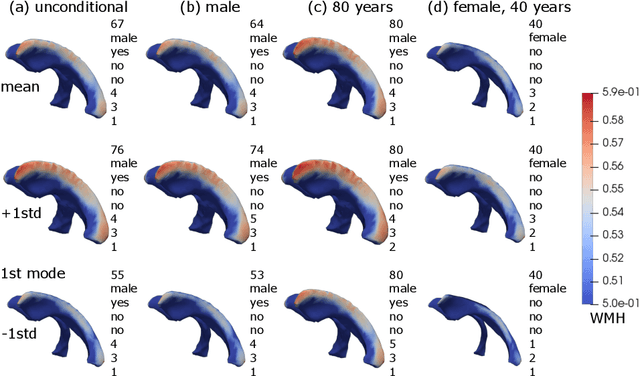 Figure 1 for Patient-specific Conditional Joint Models of Shape, Image Features and Clinical Indicators