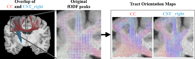 Figure 1 for Combined tract segmentation and orientation mapping for bundle-specific tractography