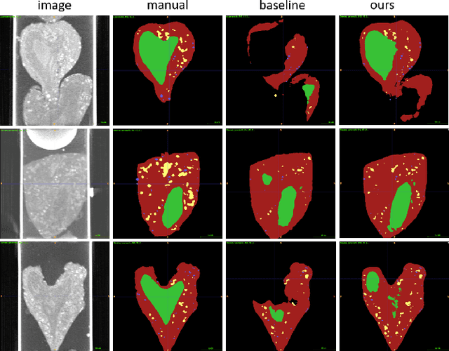 Figure 3 for Neural Network Segmentation of Cell Ultrastructure Using Incomplete Annotation