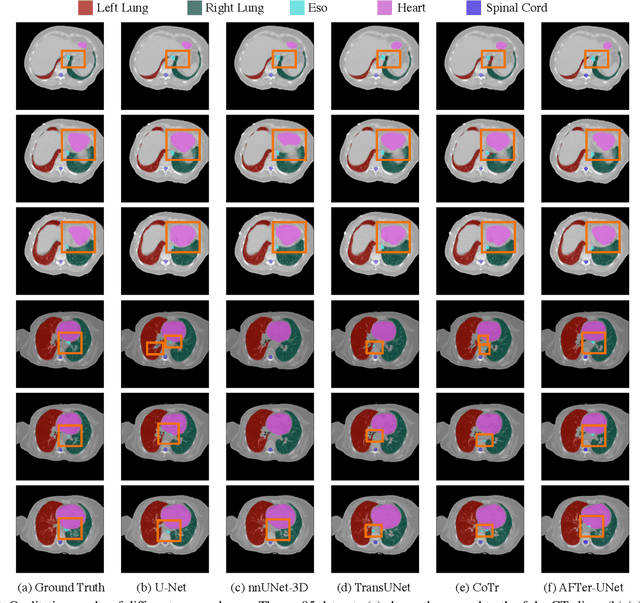 Figure 4 for AFTer-UNet: Axial Fusion Transformer UNet for Medical Image Segmentation
