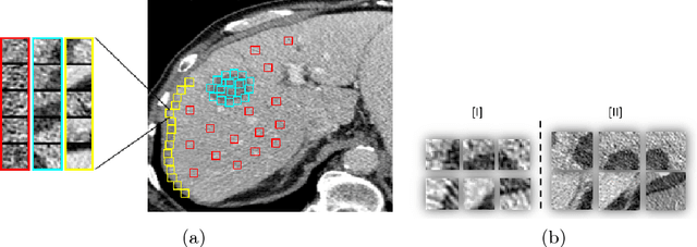 Figure 1 for Modeling the Intra-class Variability for Liver Lesion Detection using a Multi-class Patch-based CNN