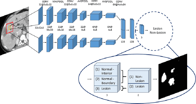 Figure 3 for Modeling the Intra-class Variability for Liver Lesion Detection using a Multi-class Patch-based CNN