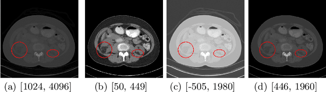 Figure 1 for MVP-Net: Multi-view FPN with Position-aware Attention for Deep Universal Lesion Detection