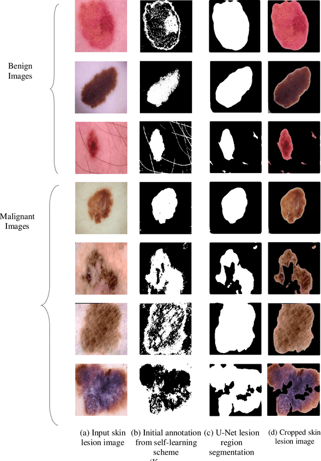 Figure 3 for Self-Learning AI Framework for Skin Lesion Image Segmentation and Classification