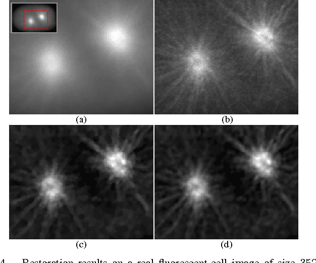 Figure 4 for Hessian Schatten-Norm Regularization for Linear Inverse Problems