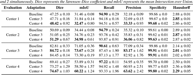 Figure 2 for Unsupervised domain adaptation for medical imaging segmentation with self-ensembling