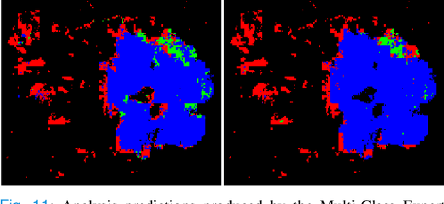 Figure 3 for Weighted multi-level deep learning analysis and framework for processing breast cancer WSIs