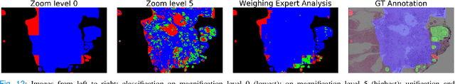 Figure 4 for Weighted multi-level deep learning analysis and framework for processing breast cancer WSIs